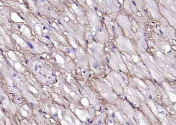 CYB5R3 Rabbit Polyclonal Antibody