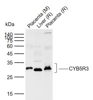 CYB5R3 Rabbit Polyclonal Antibody