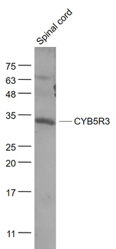CYB5R3 Rabbit Polyclonal Antibody