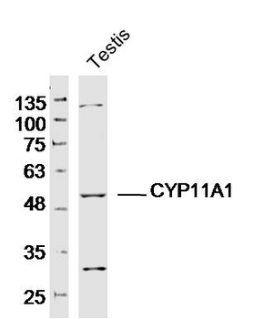 CYP11A1 Rabbit Polyclonal Antibody