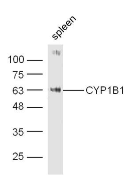 CYP1B1 Rabbit Polyclonal Antibody