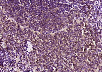 DAPP1 Rabbit Polyclonal Antibody