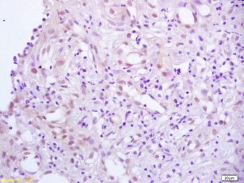 DBPA Rabbit Polyclonal Antibody