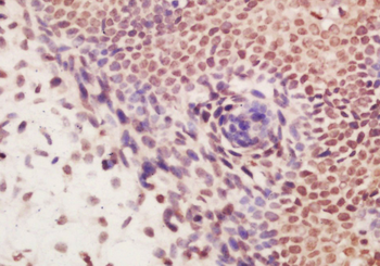 DBPA Rabbit Polyclonal Antibody