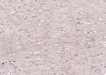 DBPA Rabbit Polyclonal Antibody