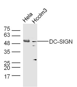 DC-SIGN Rabbit Polyclonal Antibody