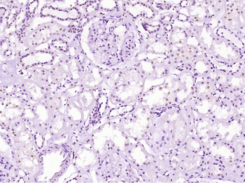 Phospho-DDX5 (Tyr593) Rabbit Polyclonal Antibody