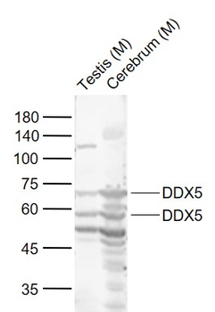 DDX5/p68 RNA Helicase Rabbit Polyclonal Antibody