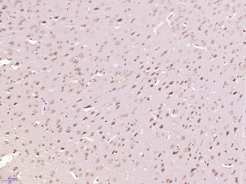 Phospho-delta 1 Catenin (Tyr228) Rabbit Polyclonal Antibody