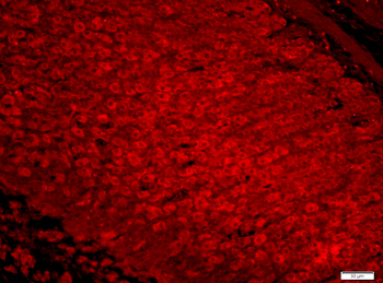 DIP13B Rabbit Polyclonal Antibody