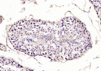 DNTNP Rabbit Polyclonal Antibody