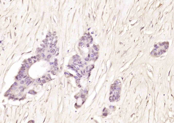 DNTNP Rabbit Polyclonal Antibody