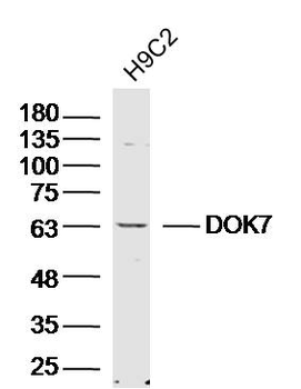 DOK7 Rabbit Polyclonal Antibody