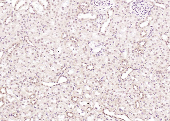 DUSP5 Rabbit Polyclonal Antibody
