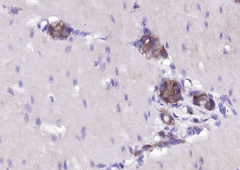 DUSP6 Rabbit Polyclonal Antibody