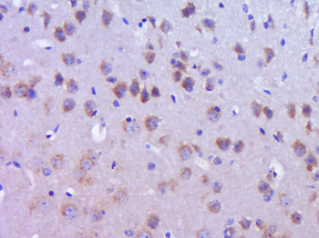 DYNC1I2 Rabbit Polyclonal Antibody