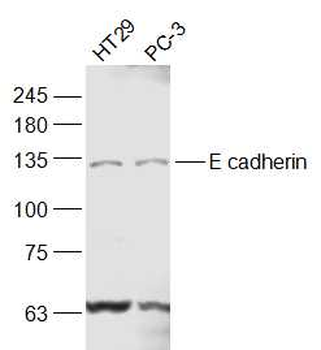 E cadherin Rabbit Polyclonal Antibody