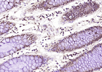EBP1 Rabbit Polyclonal Antibody