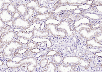 EDA Rabbit Polyclonal Antibody