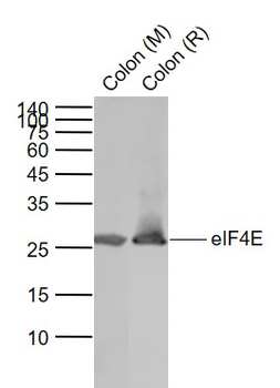 EIF4E Rabbit Polyclonal Antibody