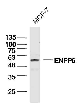 ENPP6 Rabbit Polyclonal Antibody