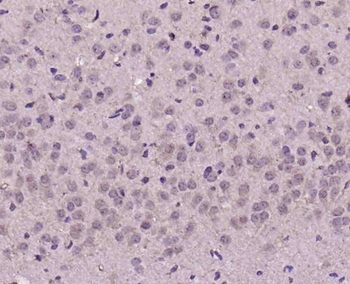 Epsin 1 Rabbit Polyclonal Antibody