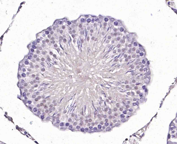 Epsin 1 Rabbit Polyclonal Antibody