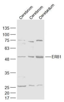ER81 Rabbit Polyclonal Antibody