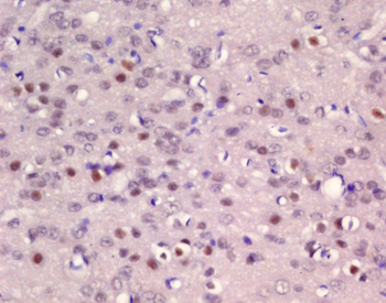 ER81 Rabbit Polyclonal Antibody