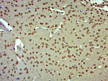 ERCC8 Rabbit Polyclonal Antibody