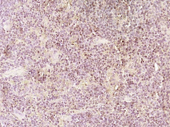 ERCC8 Rabbit Polyclonal Antibody