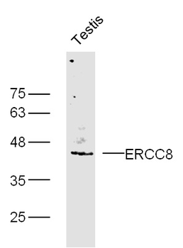 ERCC8 Rabbit Polyclonal Antibody