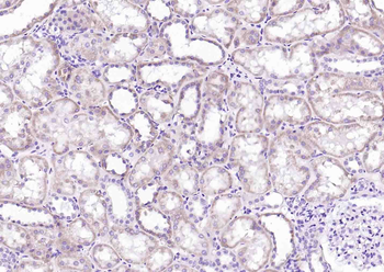 ERF1 Rabbit Polyclonal Antibody