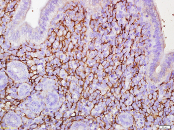ADGRL4 Rabbit Polyclonal Antibody