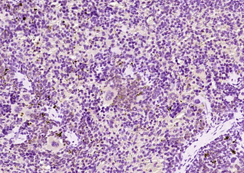 Phospho-ETS1 (Thr38) Rabbit Polyclonal Antibody