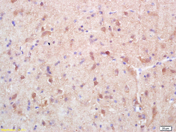 Exportin 1 Rabbit Polyclonal Antibody