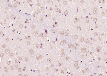 EXTL3 Rabbit Polyclonal Antibody