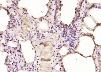 EYA2 Rabbit Polyclonal Antibody