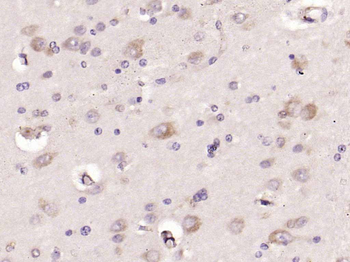 Factor VIII B chain Rabbit Polyclonal Antibody