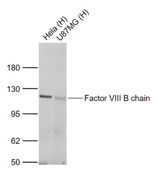 Factor VIII B chain Rabbit Polyclonal Antibody
