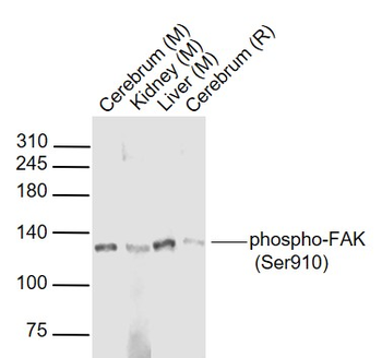 Phospho-FAK (Ser910) Rabbit Polyclonal Antibody