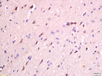 FAM134B Rabbit Polyclonal Antibody