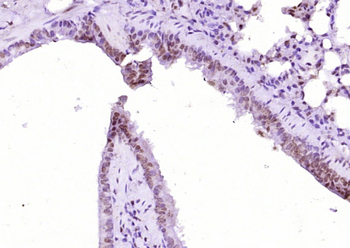 FAN1 Rabbit Polyclonal Antibody