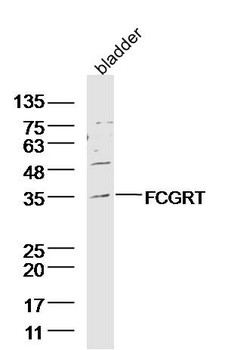FCGRT Rabbit Polyclonal Antibody