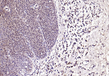 Phospho-FGFR1 (Tyr154) Rabbit Polyclonal Antibody