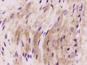 FLNC Rabbit Polyclonal Antibody