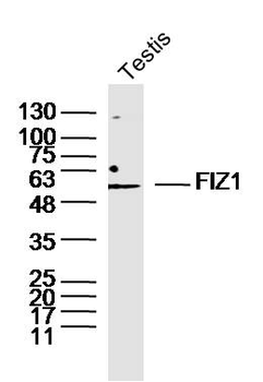 FIZ1 Rabbit Polyclonal Antibody