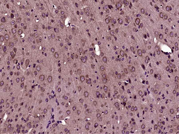 Phospho-FLNC (Ser2233) Rabbit Polyclonal Antibody