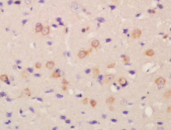 FLRT2 Rabbit Polyclonal Antibody