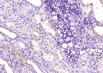 FMN1 Rabbit Polyclonal Antibody